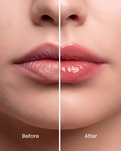 VANILLA - PEPTIDE LIP BARRIER MASK - Image 2